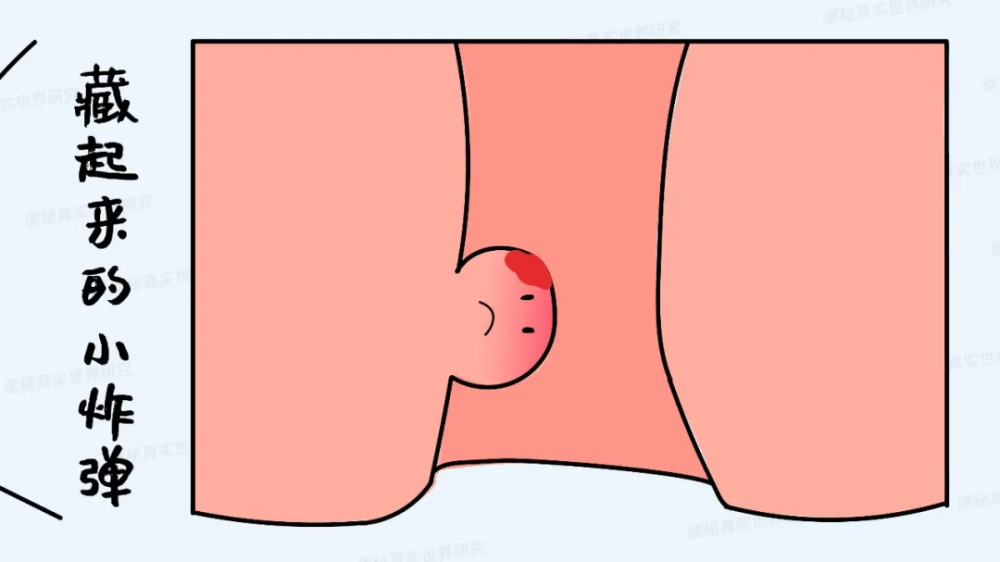 肛门口有小肉球，要进行治疗吗