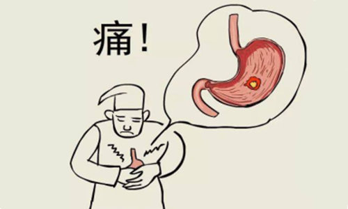 渐江18岁小伙最近腹痛难忍，经检查却发现长了两个“胃”