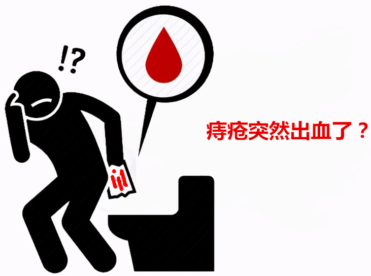痔疮突然出血,如何进行紧急处理