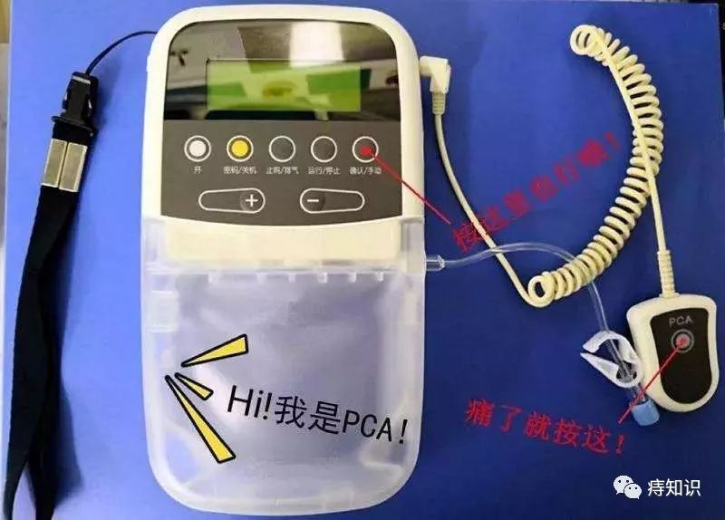 混合痔手术后使用自控镇痛泵的注意事项