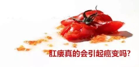 肛瘘会癌变吗