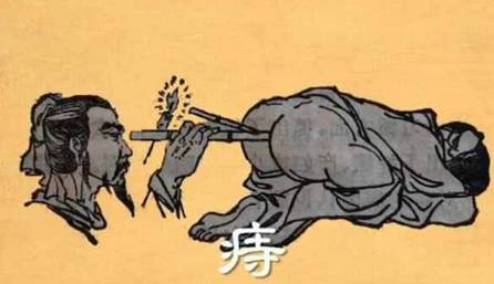 让上班男人不得痔疮的六个习惯