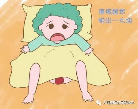内痔的分类